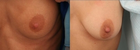 Case 4
