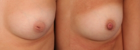 Case 5