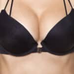 Ideal Breast implants