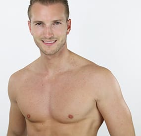 Gynecomastia