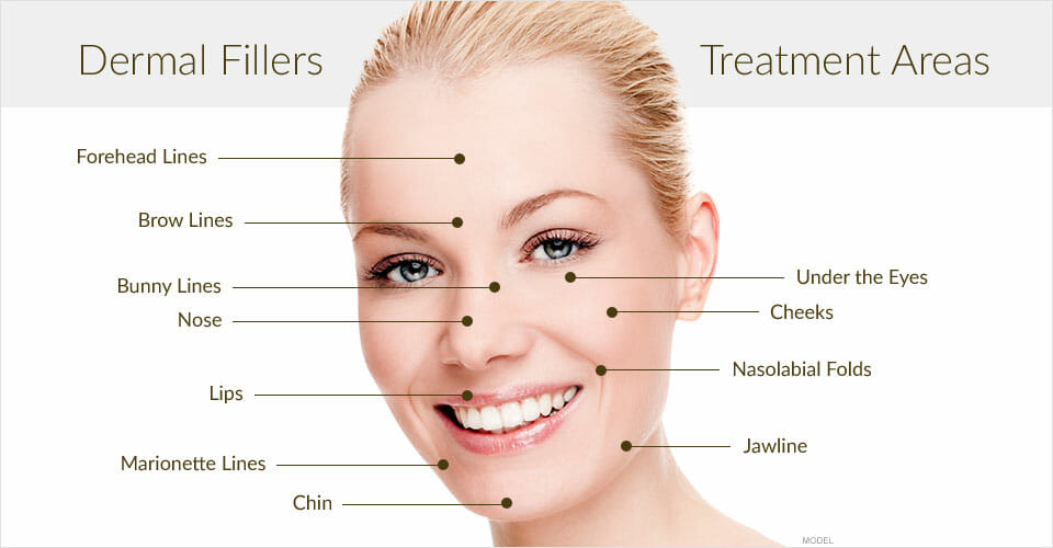 Facial Fillers Baltimore MD