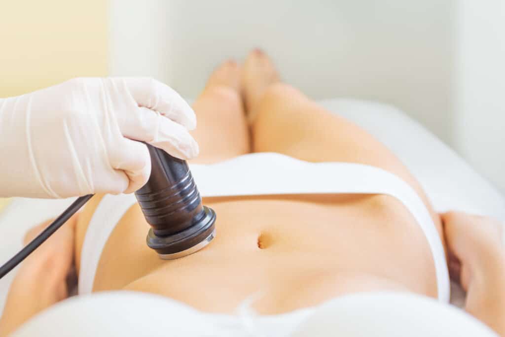 Ultrasonic-Assisted Liposuction Recovery