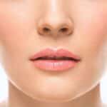 Fat Transfer for Facial Rejuvenation