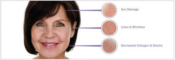 Alastin Skin Care Baltimore MD