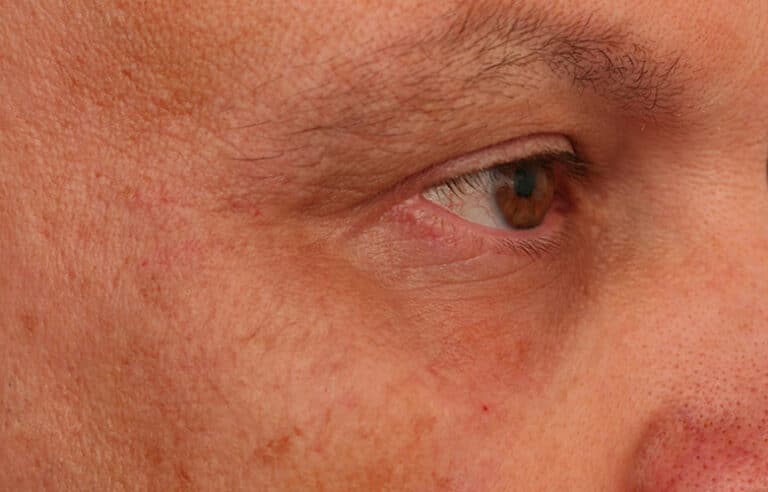 After Image: Crows Feet Volbella - right-front-oblique