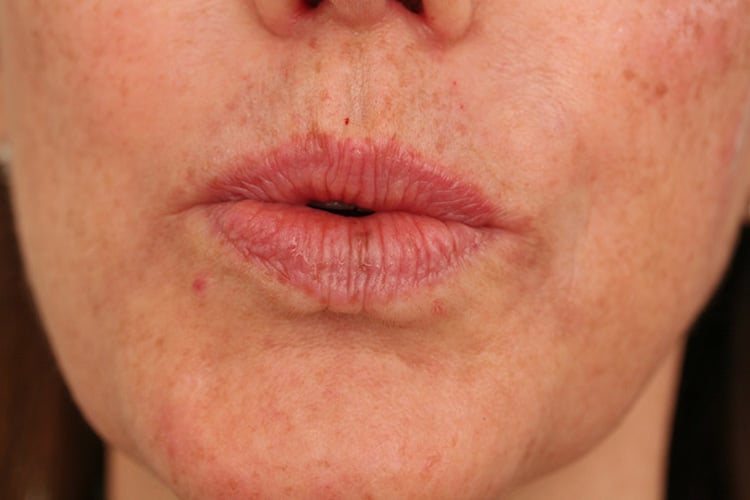 After Image: Lips Volbella - front