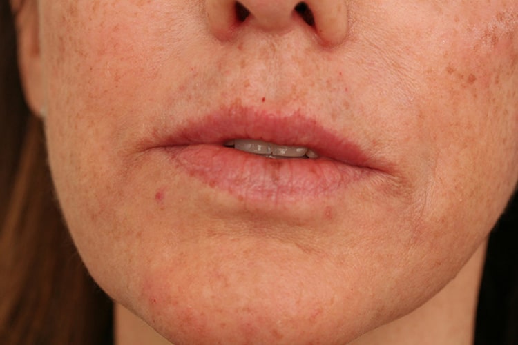After Image: Lips Volbella - front