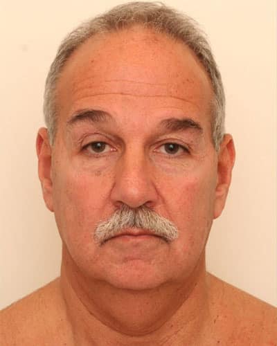 Before Image: Facelift - front