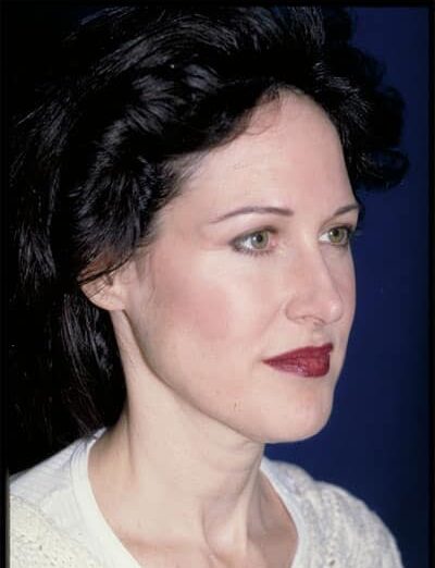 Before Image: Facelift - right-front-oblique