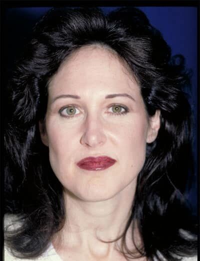 Before Image: Facelift - front