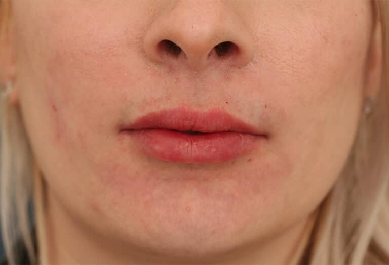 After Image: Lips Defyne - front