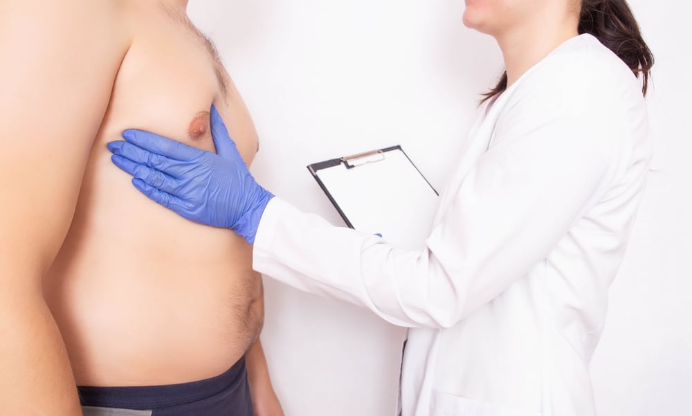 Grades and Types of Gynecomastia Baltimore MD