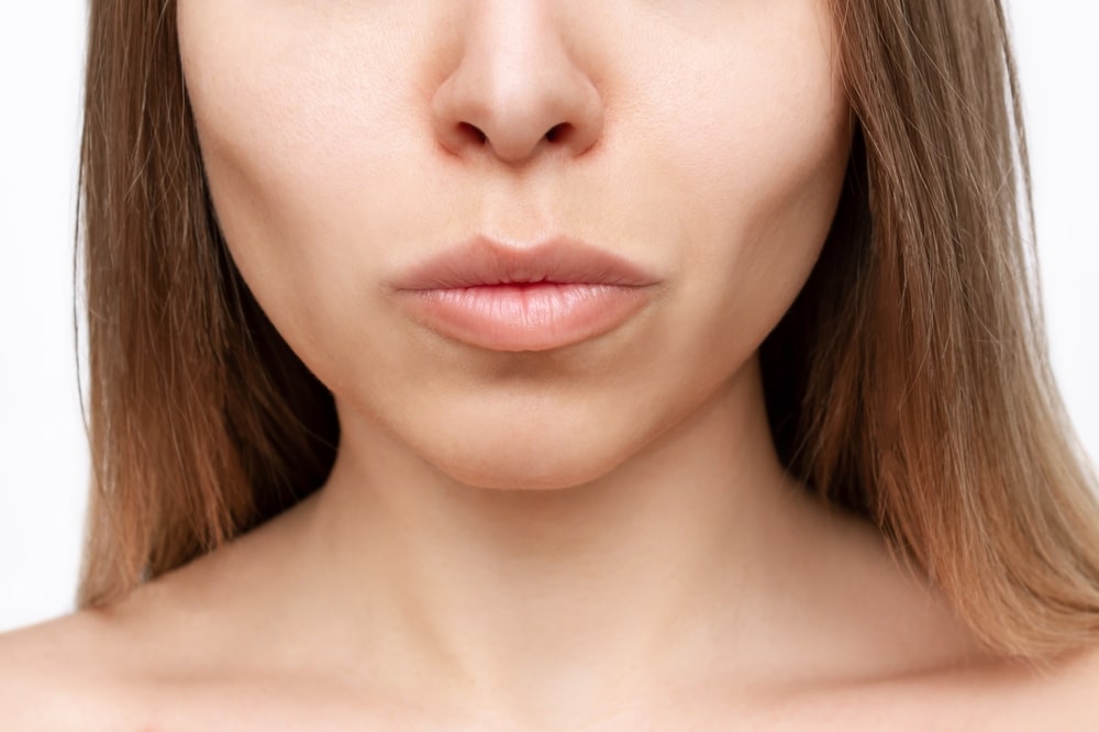 Woman with slim cheeks after buccal fat removal in Baltimore