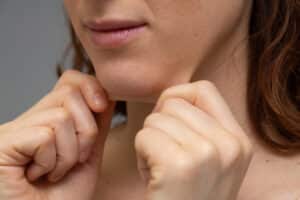 Young woman tugging at loose skin under chin after losing weight with Ozempic.