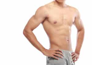 Male torso showing a flatter chest contour after gynecomastia treatment.